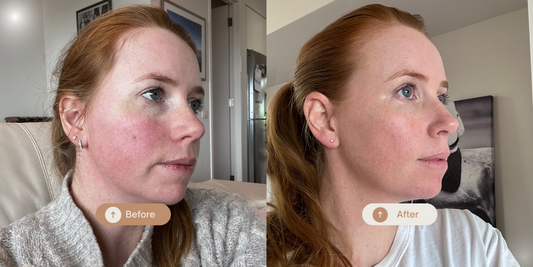 Pigmentation: Why Your Skin’s Acting Up - And How Nature Has the Answer